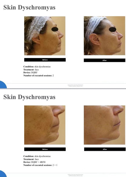ERA無瑕時代療程 🇮🇹 Face Neck Body Skin Treatment